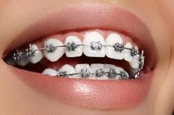 ORTODONT > cabinet ortodontie si aparate dentare, Baia Mare, MM, m6161_1.jpg