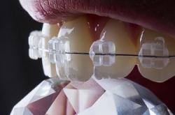 ORTODONT > cabinet ortodontie si aparate dentare, Baia Mare, MM, m6161_3.jpg